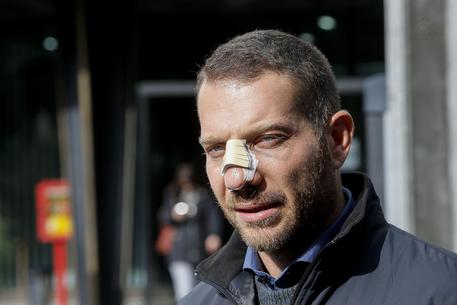 Ostia:aggredì reporter,chiesti 8 anni-9 mesi per Spada